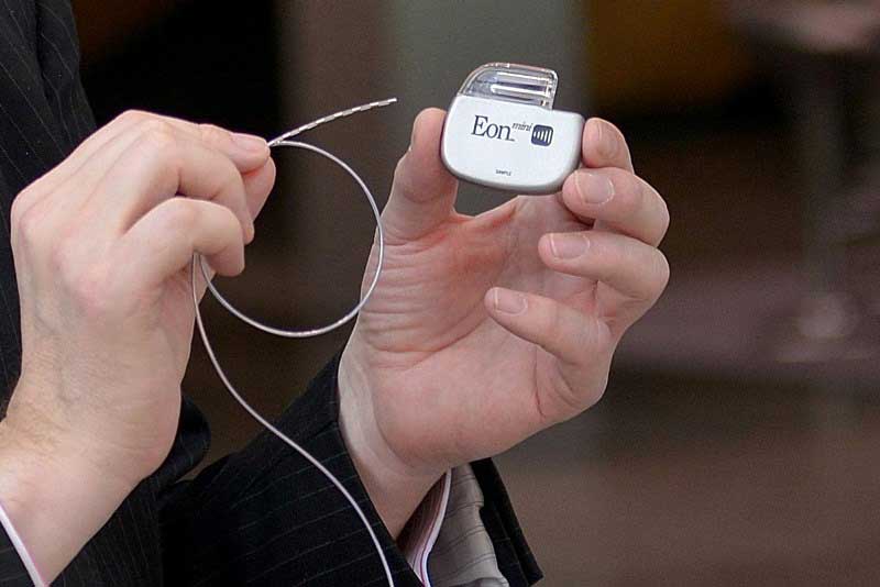 neurostimulationsgerat-und-ons-elektroden