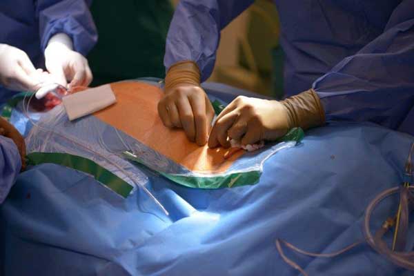 ons-migrane-kiel-204