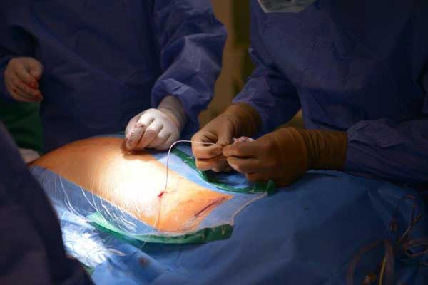 ons-migrane-kiel-240