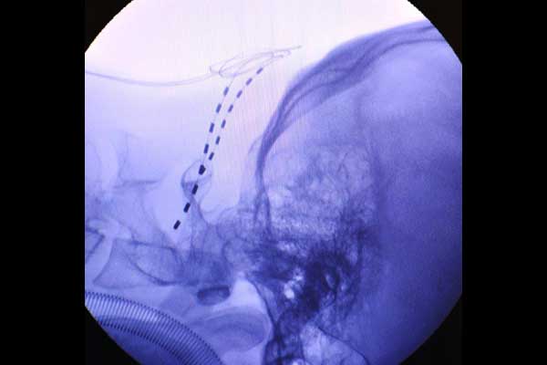 ons-migrane-kiel-399